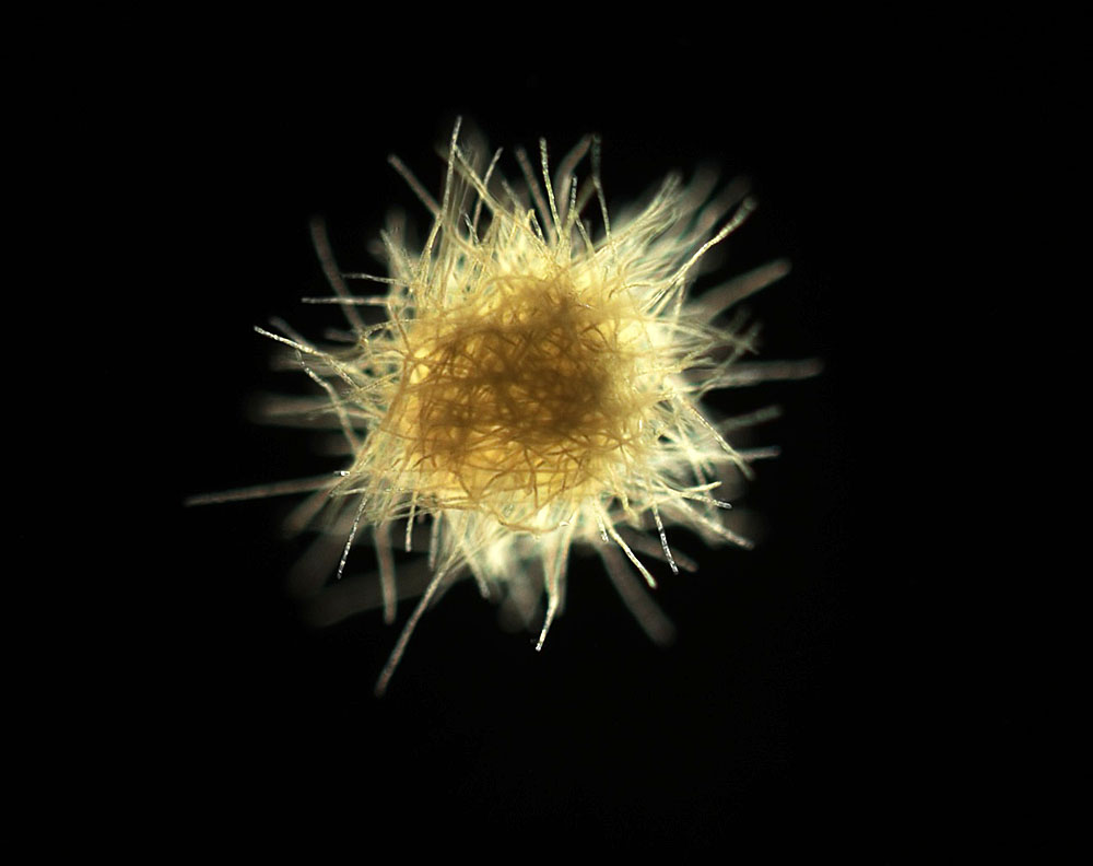2016/08/bacteria-Trichodesmium_1big_NSF.jpg