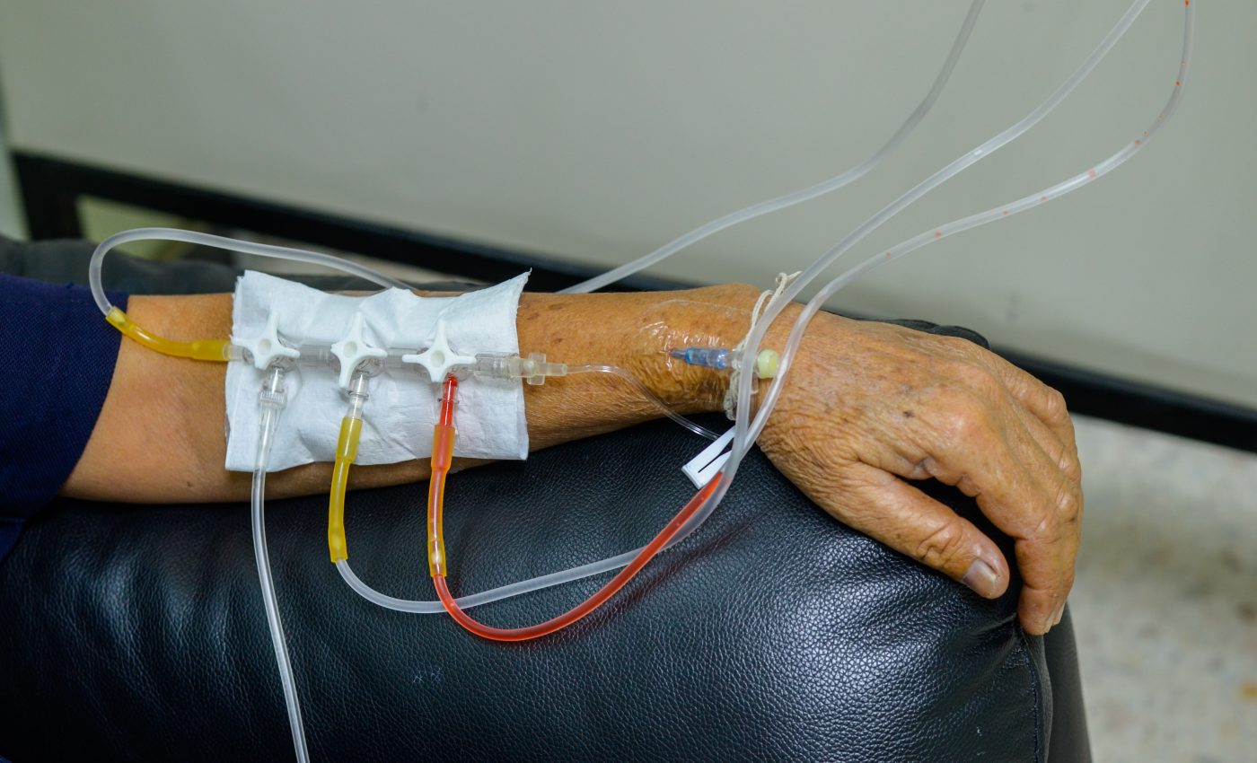 Cancer cells hibernate like bears to survive chemotherapy