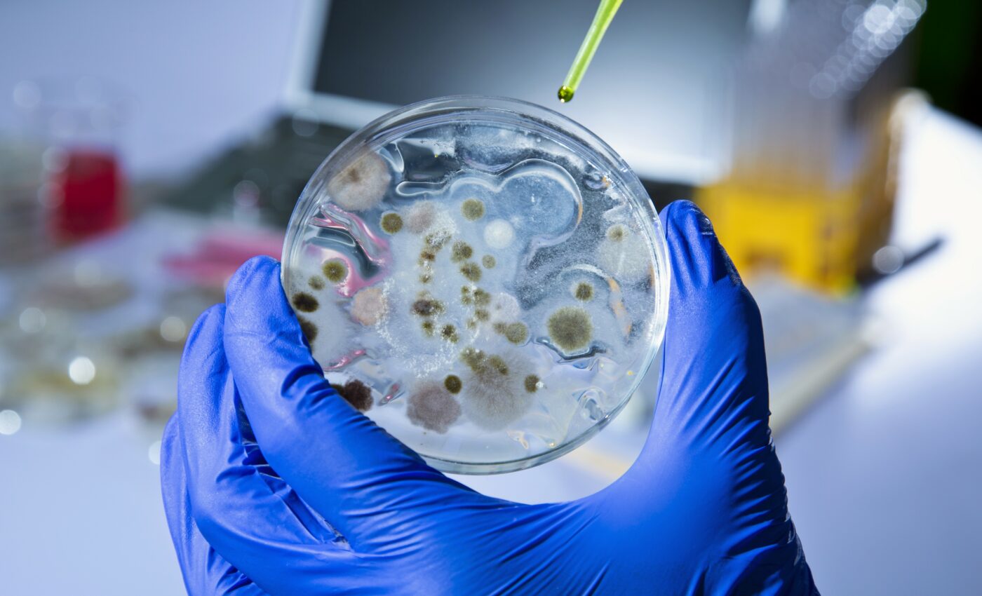 Study identifies an anthrax toxin that can alleviate pain