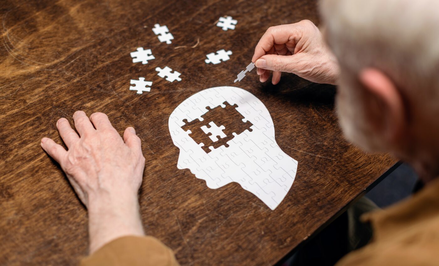 Global dementia cases may triple by 2050