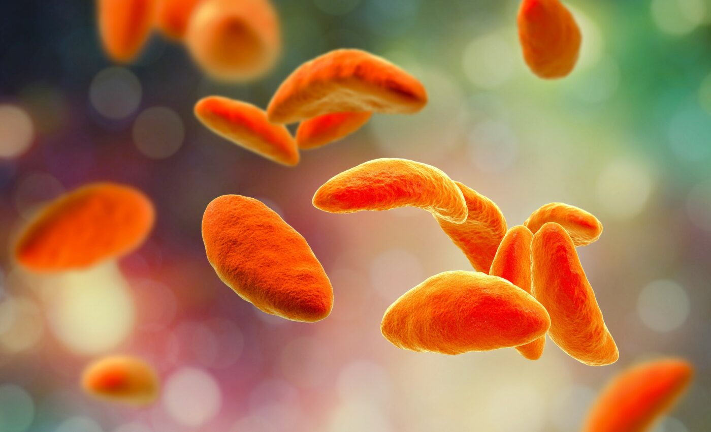 Parasite makes infected people look more attractive