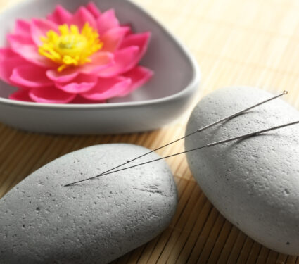 Acupuncture,Needles,With,Stones,On,Bamboo,Mat