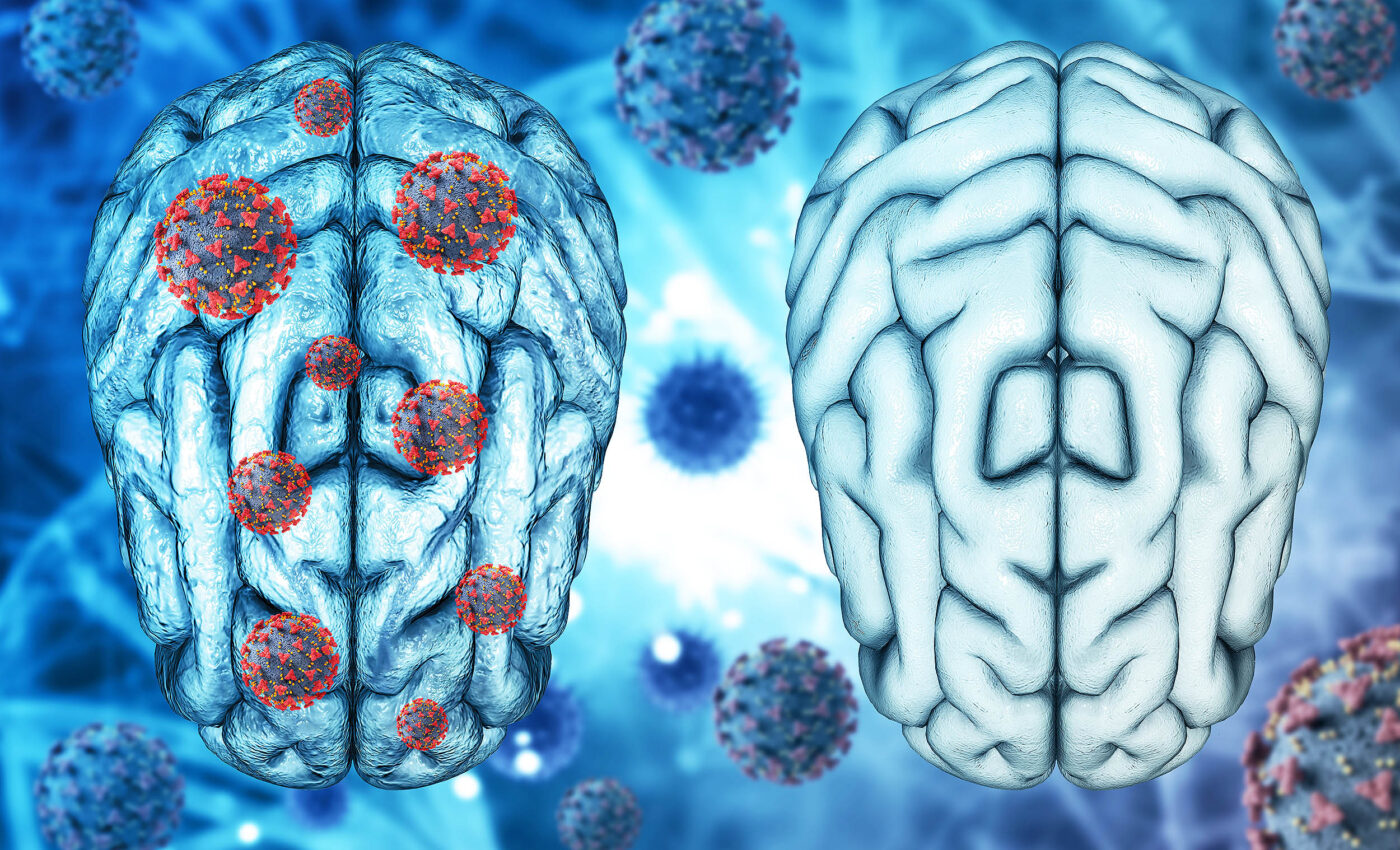 Long COVID leaves blood markers that can be targeted for treatment