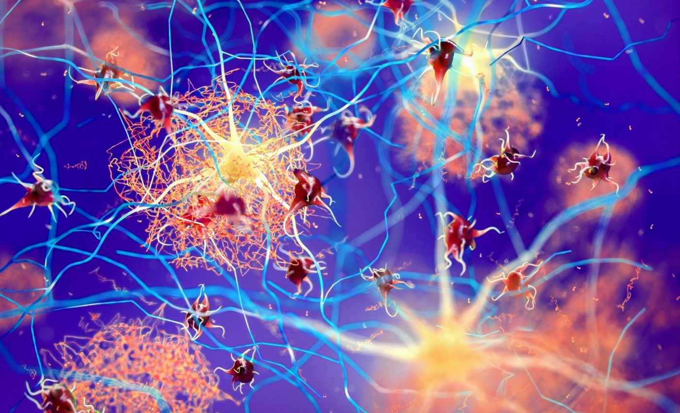 Finger prick method could simplify Alzheimer's testing