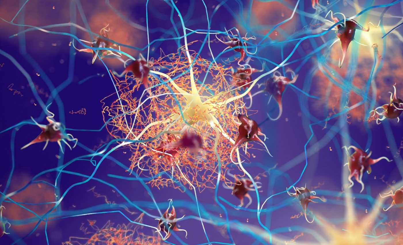 Stopping Alzheimer’s before it starts: Early treatment shows potential