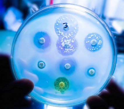 Antimicrobial,Susceptibility,Testing,In,Petri,Dish.,Microbiologist,Check,Antibiotic,Resistance