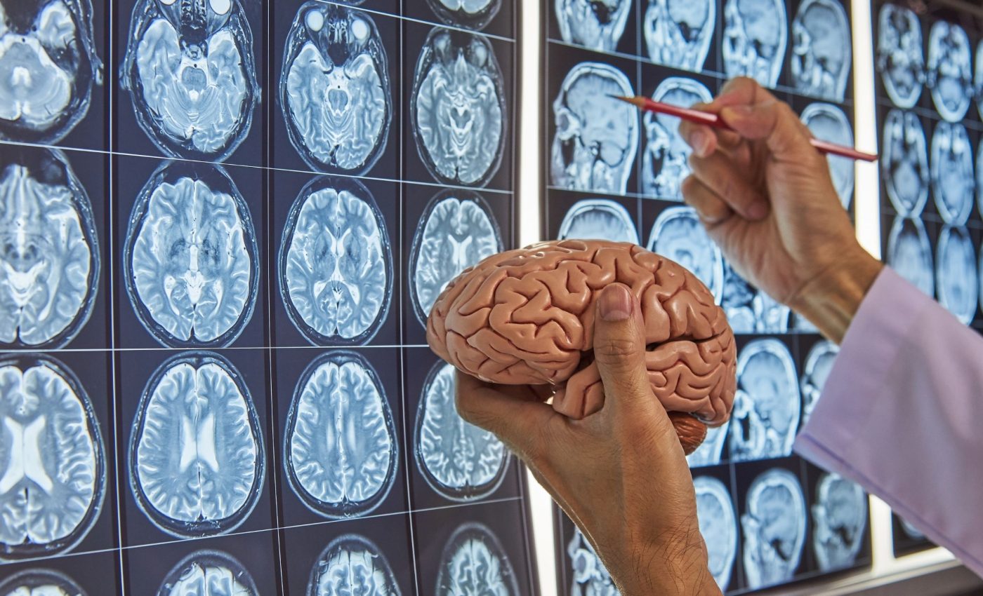 Molecules produced by the body during fasting improve brain health