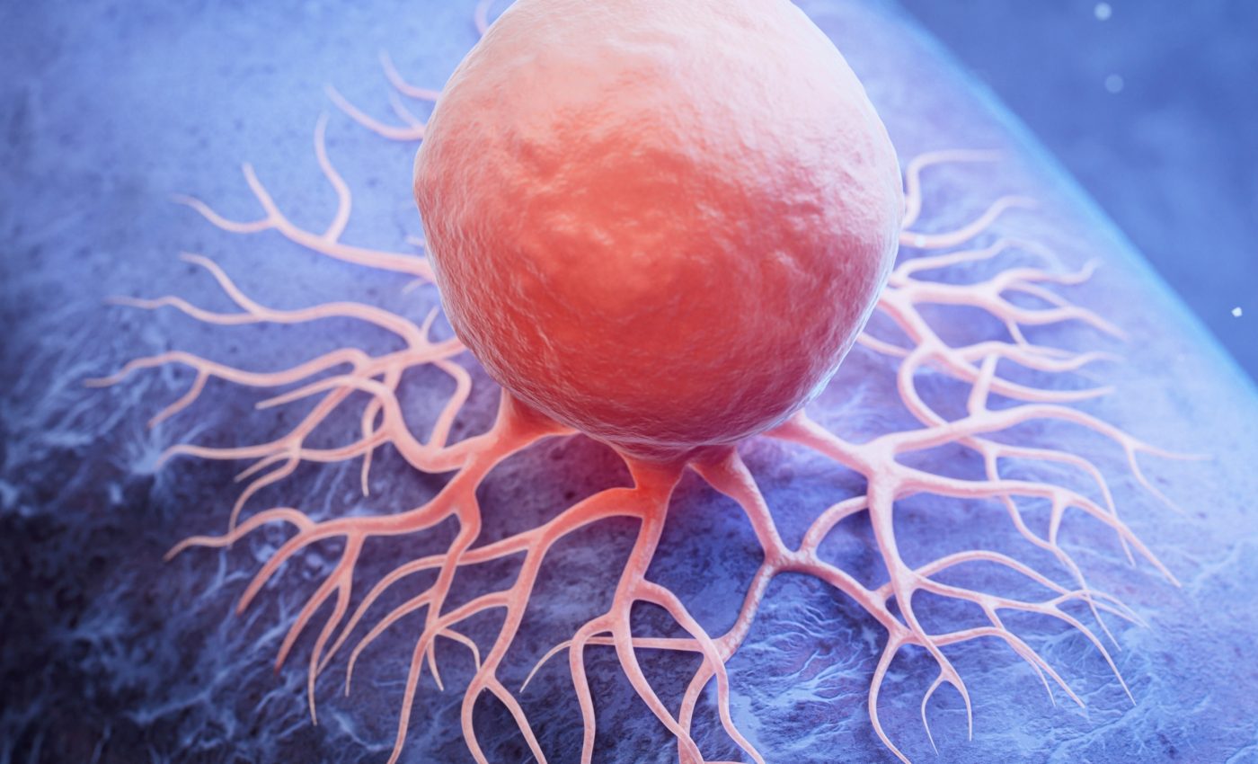 Cancer cells create power waves to fuel invasion