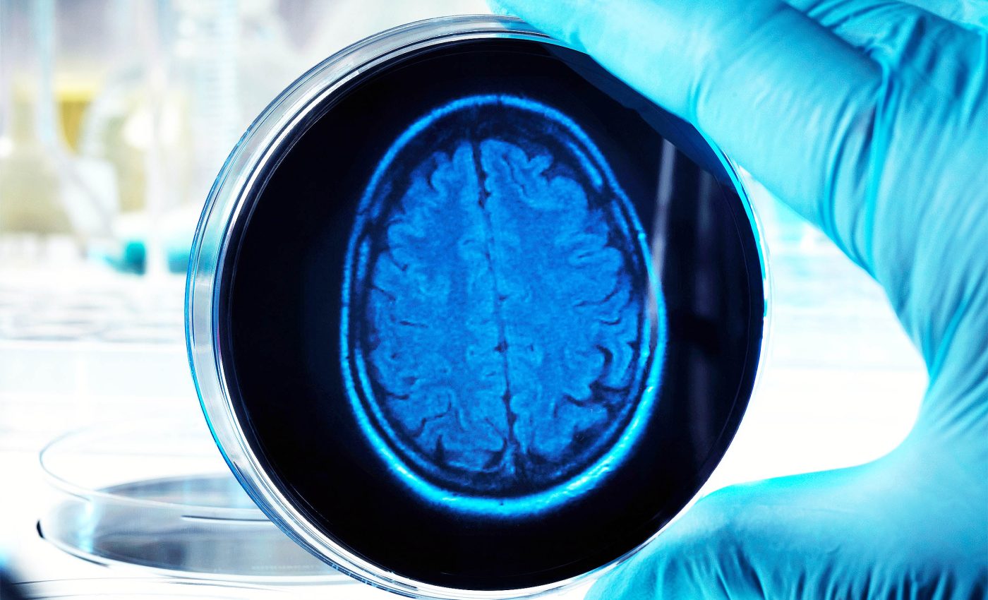 'Mini-brains' created in the lab to help fight neurological diseases