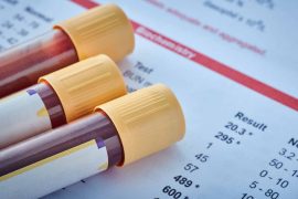 2025/09/alzheimers-blood-test-lab-sample.jpg
