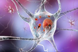 2025/09/Parkinsons-brain-cells.jpg