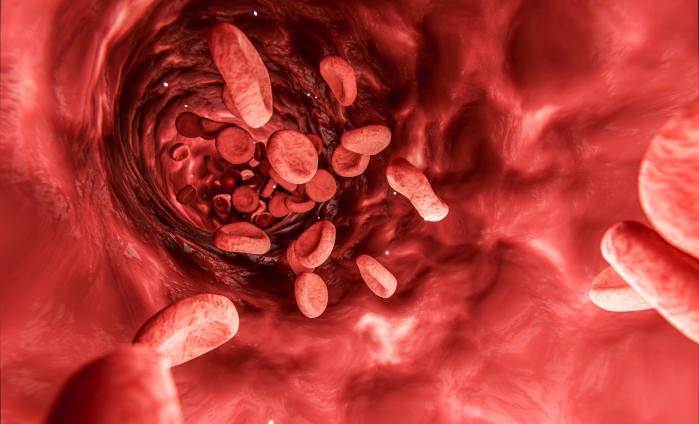 Tiny blood vessels may fuel the spread of cancer cells