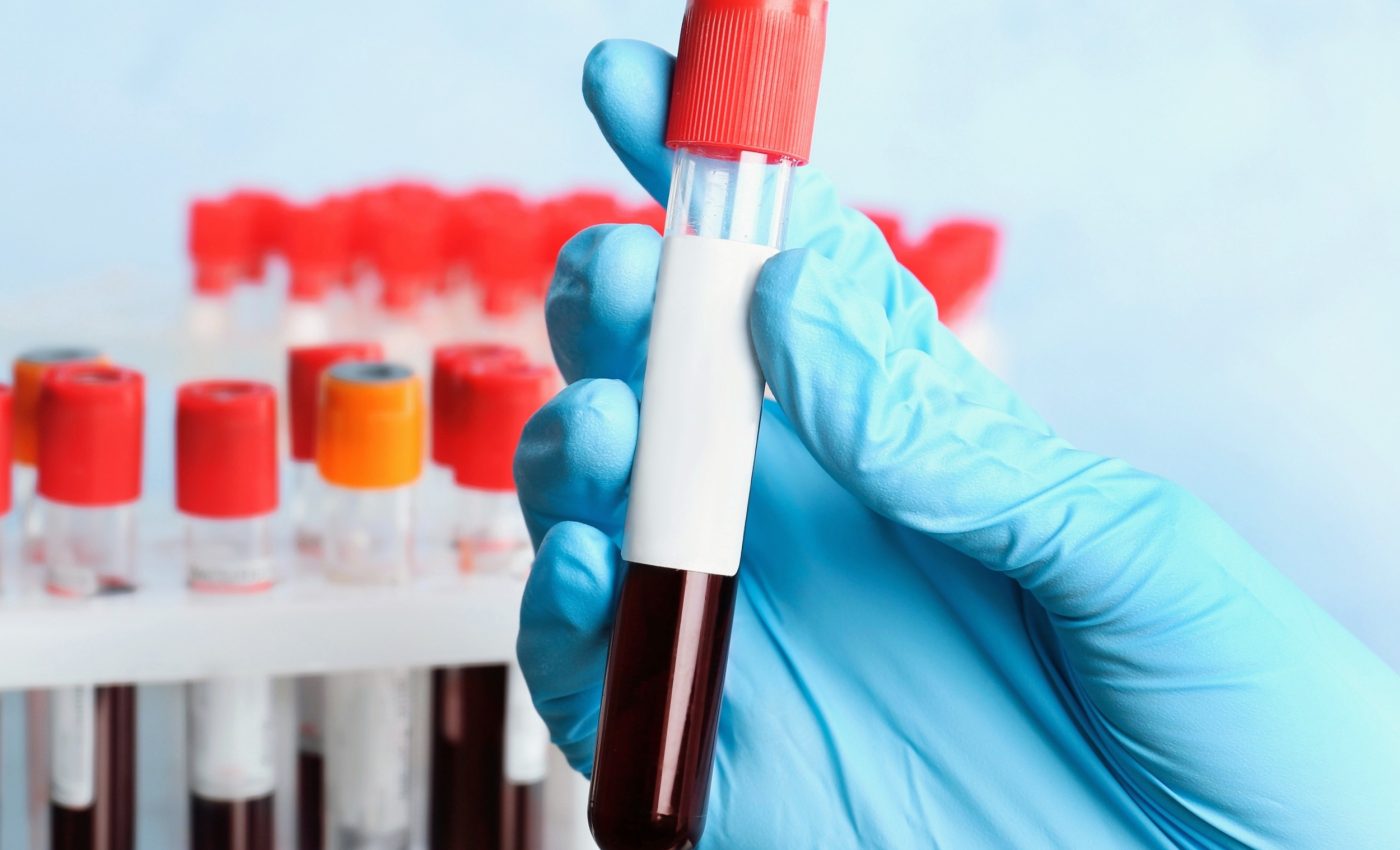 Simple blood test could spot health risks years before symptoms
