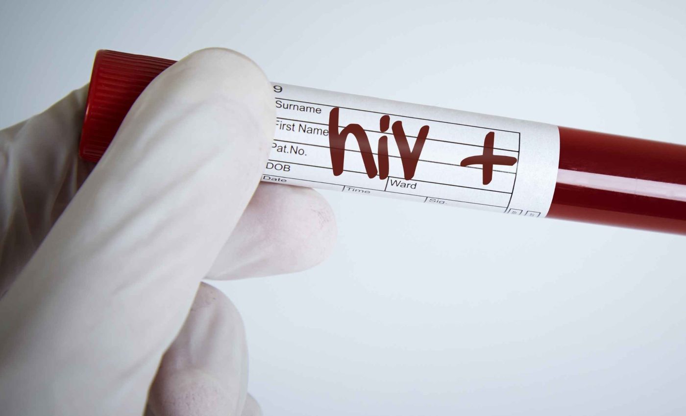 Historic breakthrough: WHO promotes new tool to curb HIV infection rates