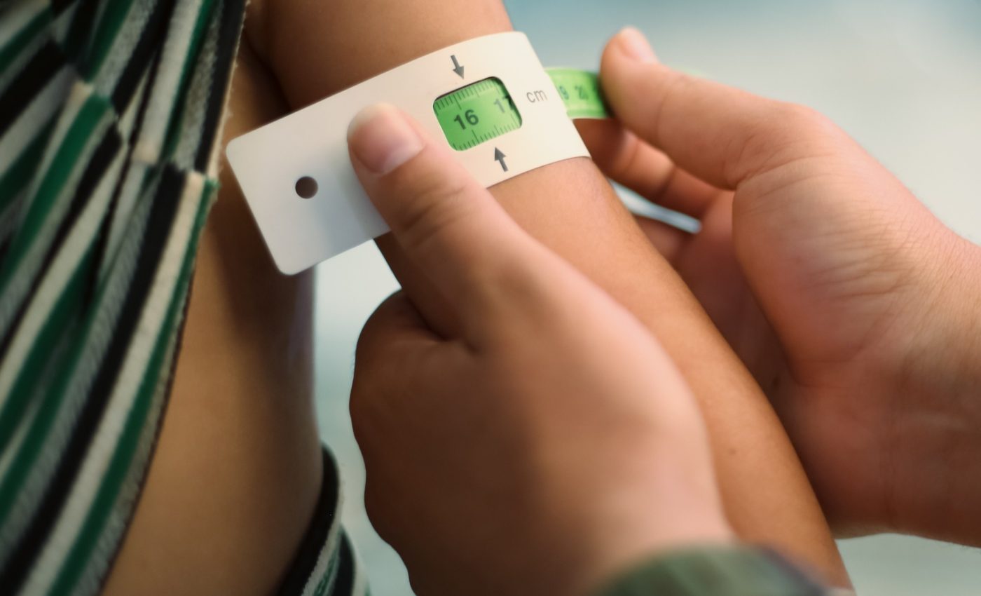 Unstable gut microbes can worsen child malnutrition