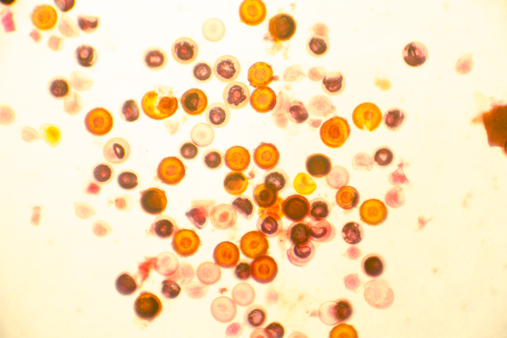 Sushi lovers shudder as scientists warn of salmon tapeworm