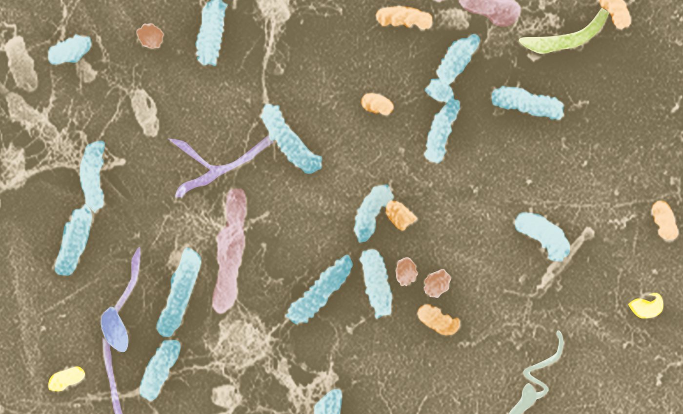 Root bacteria is critical in protecting the health of plants