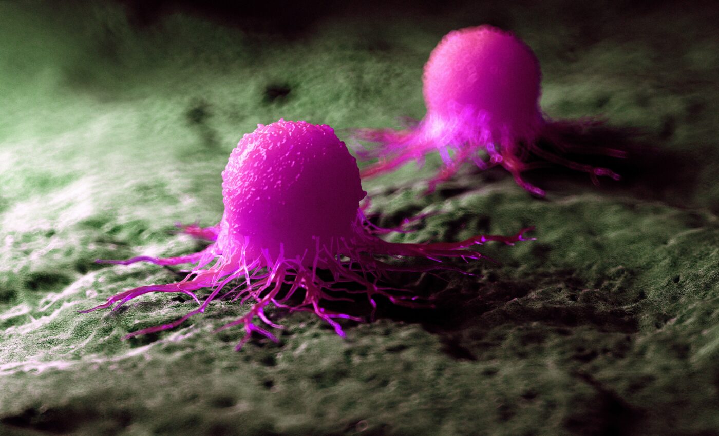 Cancer research: AI will change the way we see tumors