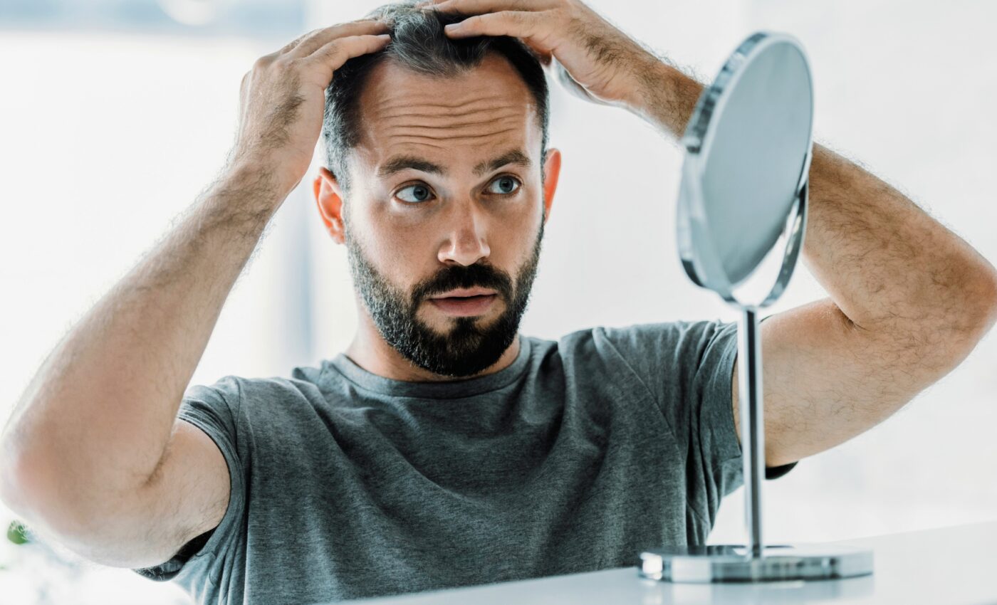 Fat injection therapy offers hope for reversing baldness