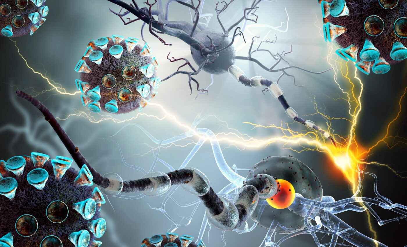 COVID harms the brain through inflammation, not infection