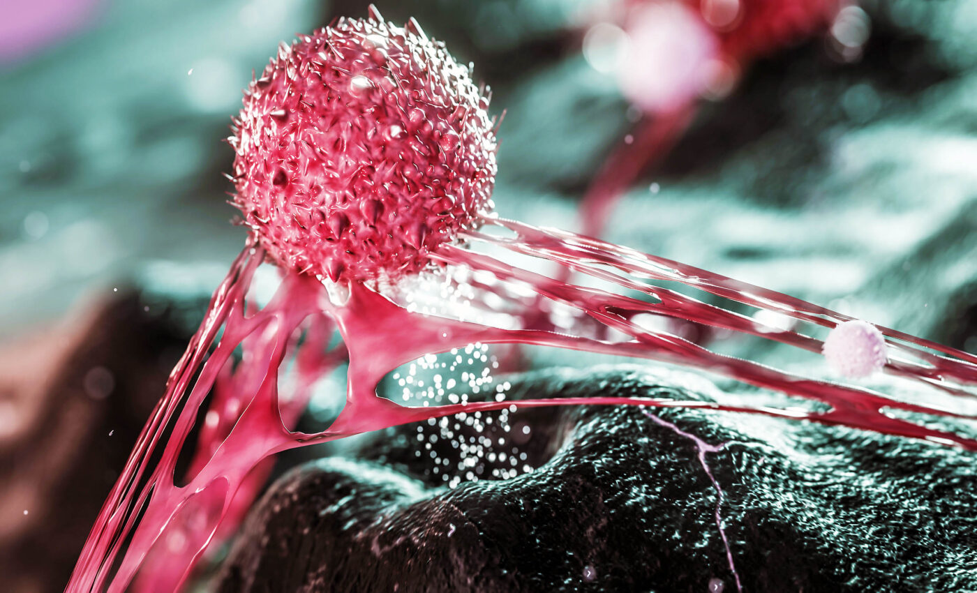 Micro- and nanoplastics, MNPs, proven to help cancer cells spread