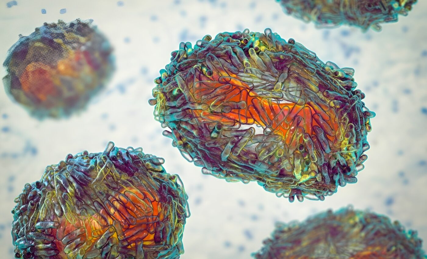 The infectious disease landscape is changing, and we must prepare