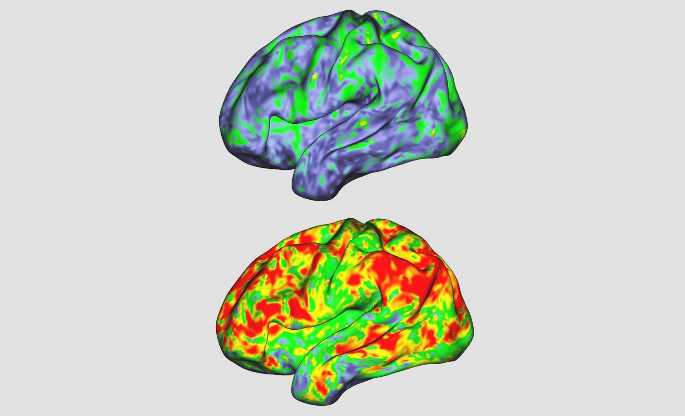 This is your brain, this is your brain on 'magic mushrooms'