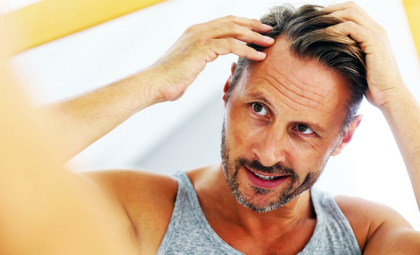 Reversing male baldness is closer to reality with natural new treatment