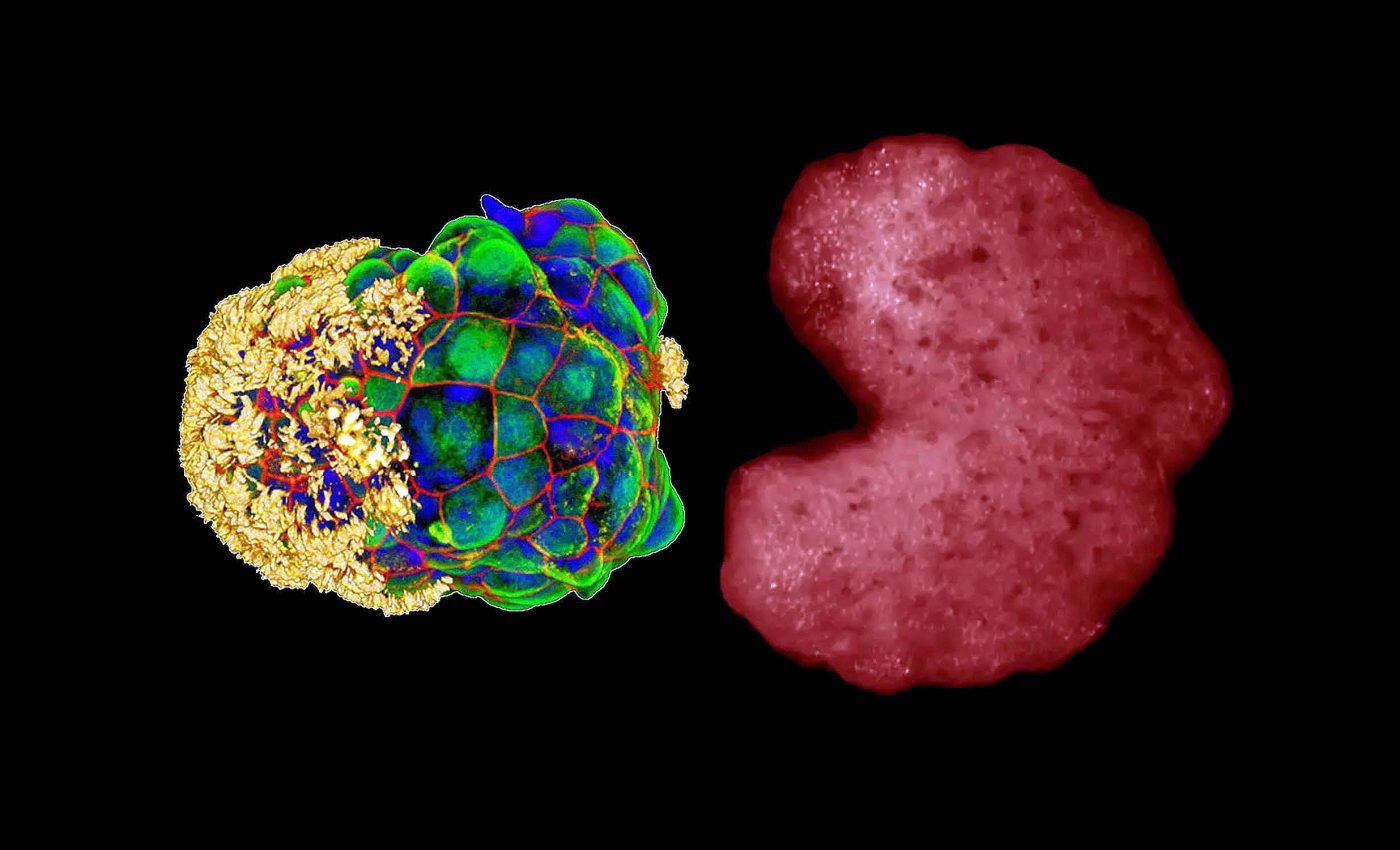 "Third state" of existence between life and death confirmed by scientists