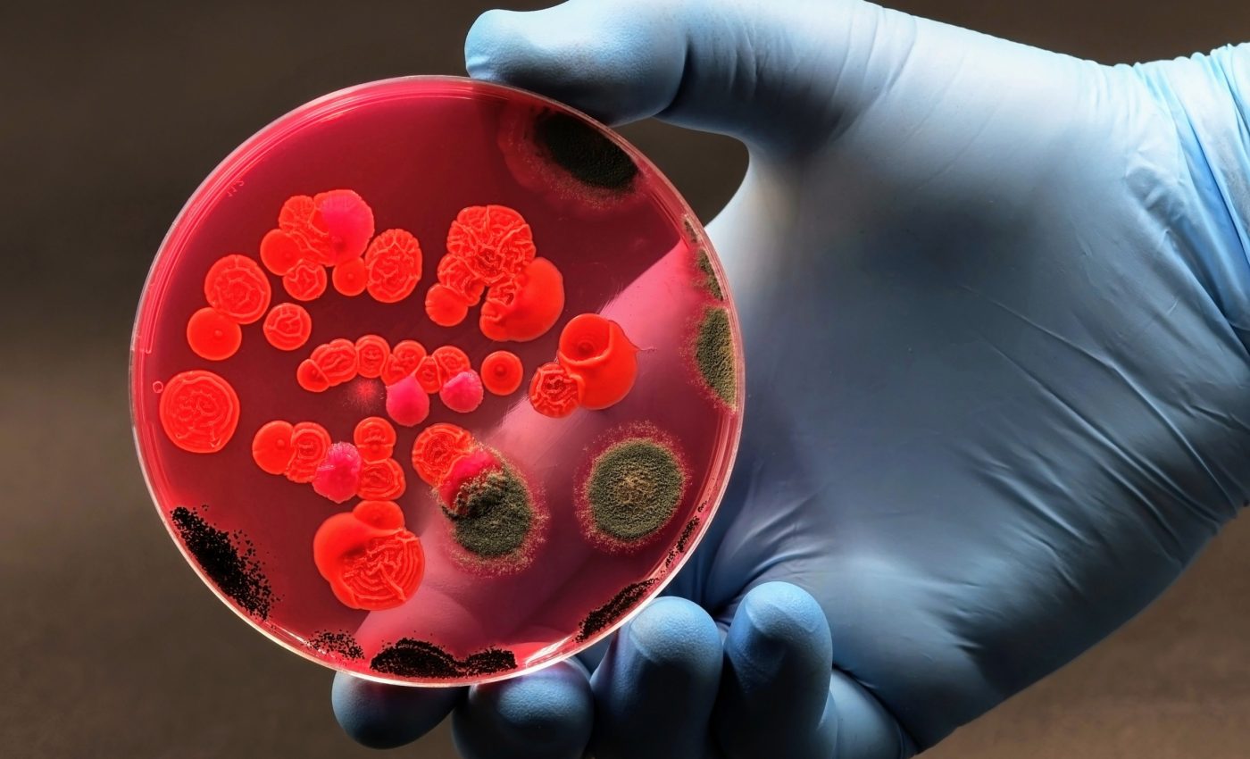 Antibiotic meds resistance could cause 39 million deaths by 2050