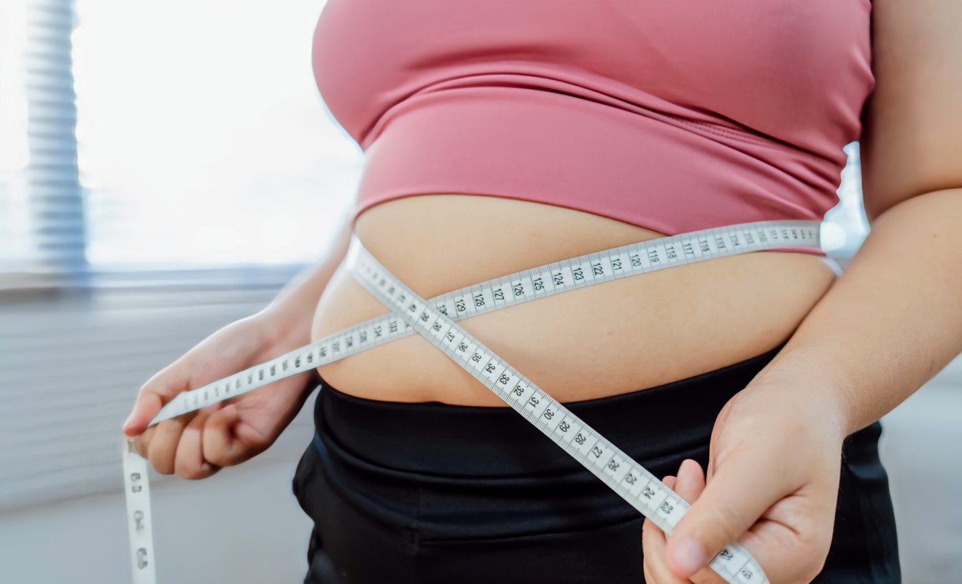 75% of U.S. adults are overweight in what doctors are now calling "an epidemic"