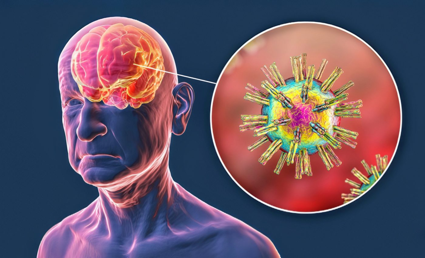 Human brains hold dormant viruses that come to life if you hit your head