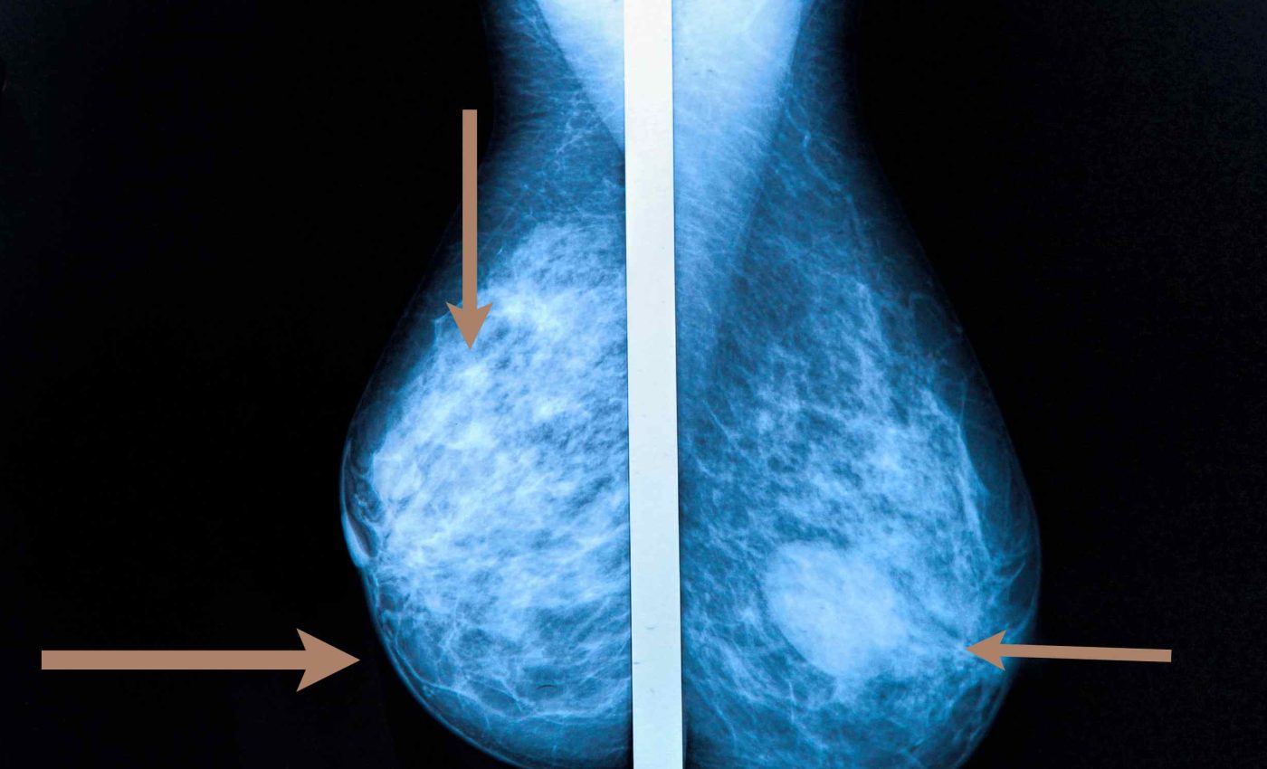 Health care providers encourage these key medical tests for women over 50