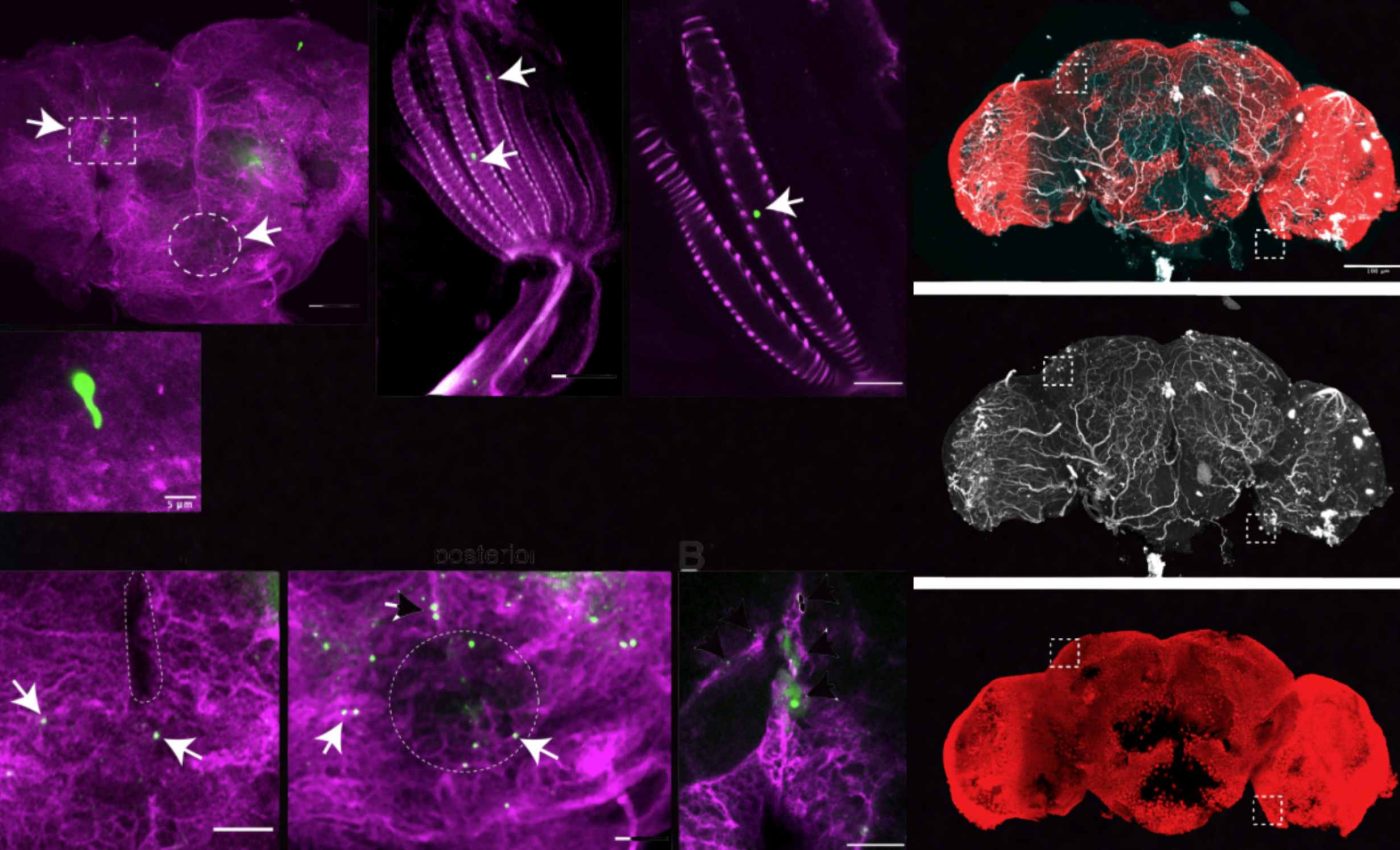Brain-eating fungus causes the immune system to attack neurons