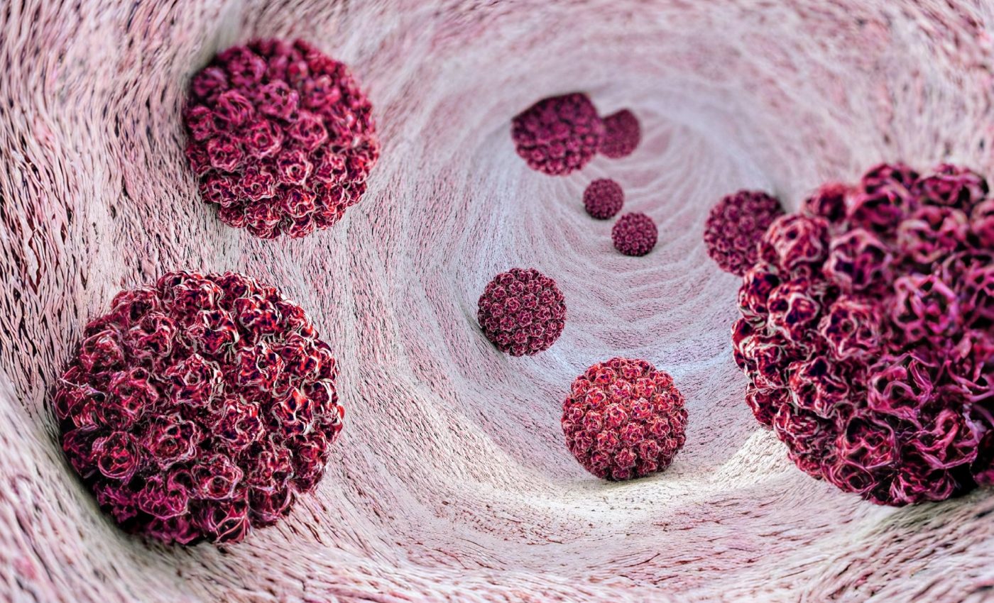 Hidden heart risk of HPV: What new research reveals