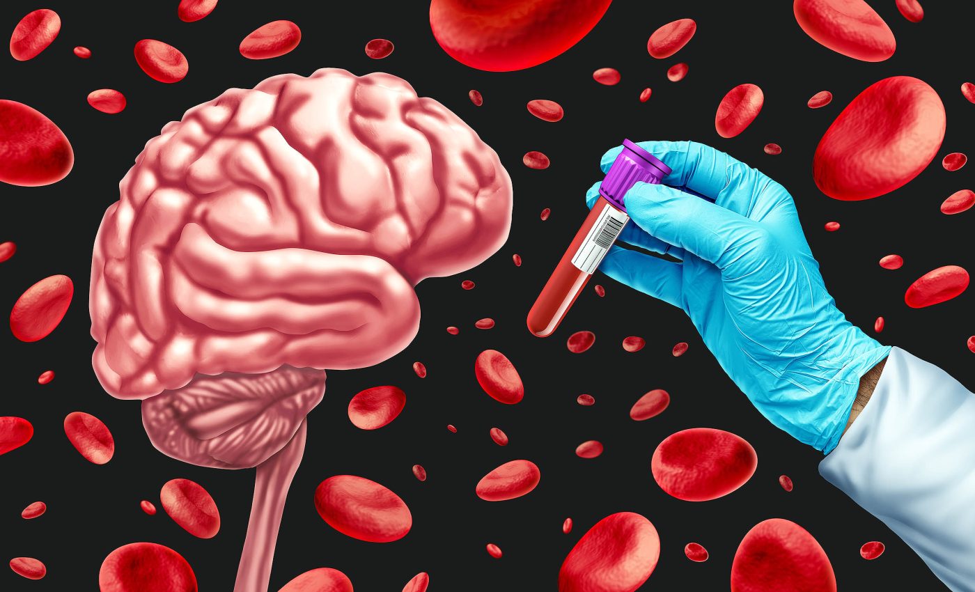 Breakthrough: New blood test for early detection of Alzheimer's disease