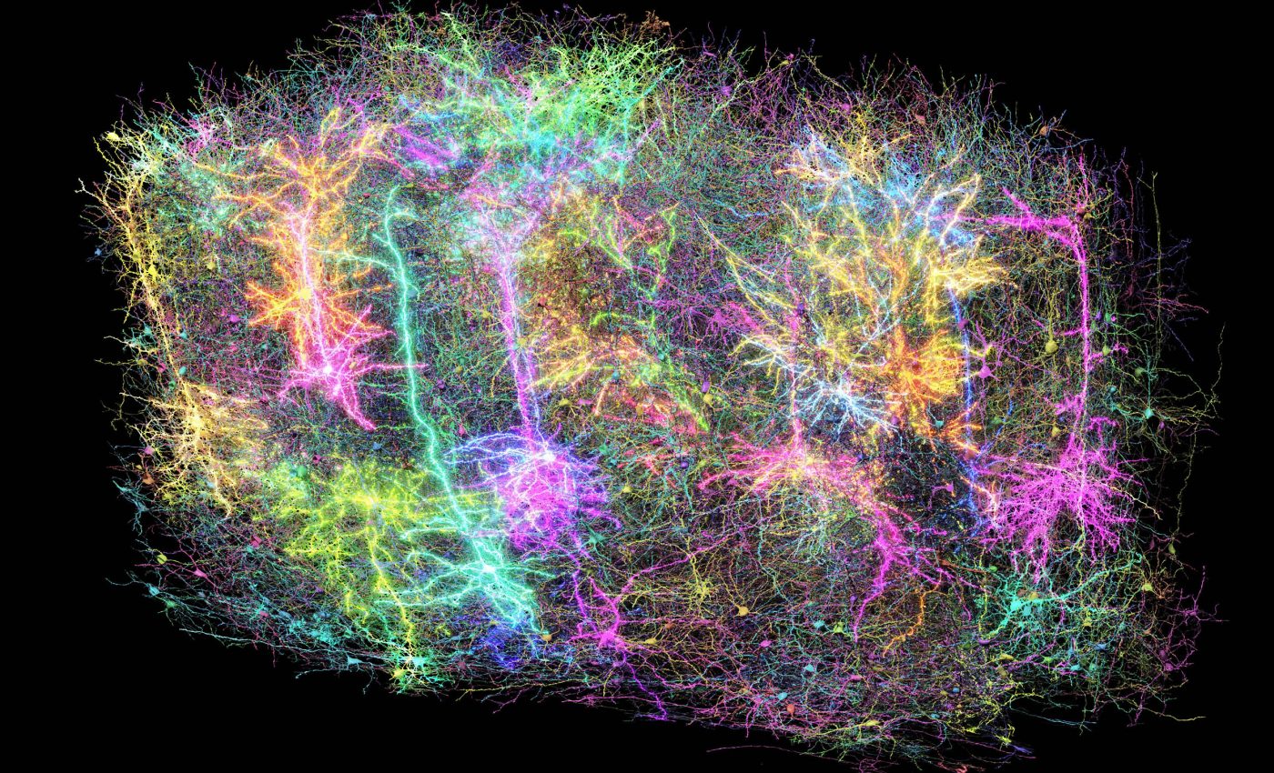 Huge advance in brain research that was supposed to be 'impossible'