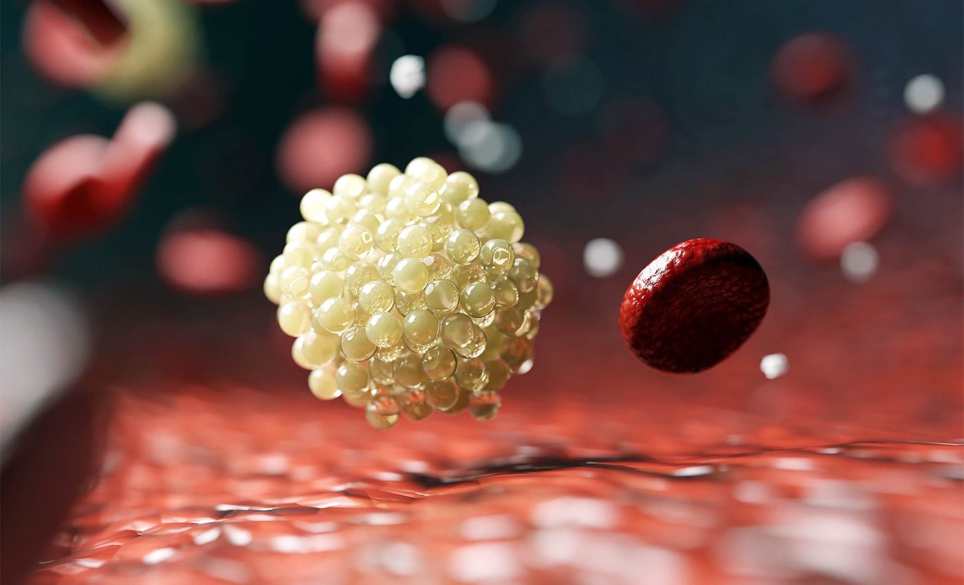 Quick blood test can now show exactly how much ultra-processed junk food a person eats