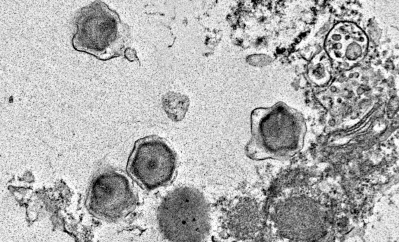 Giant viruses hijack ocean plants to control marine food webs