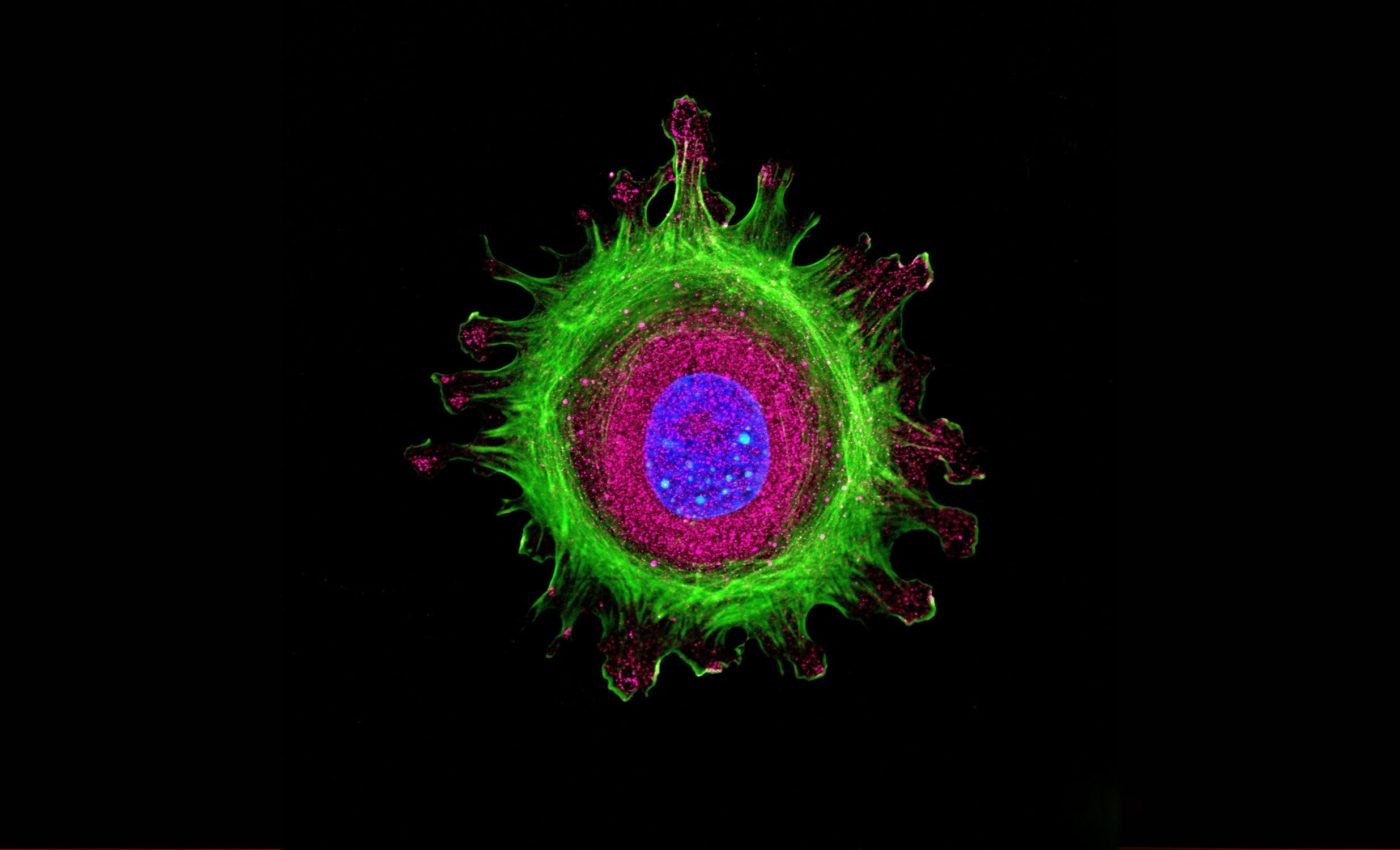 System that identifies and kills dying cells before they harm you has huge anti-aging potential