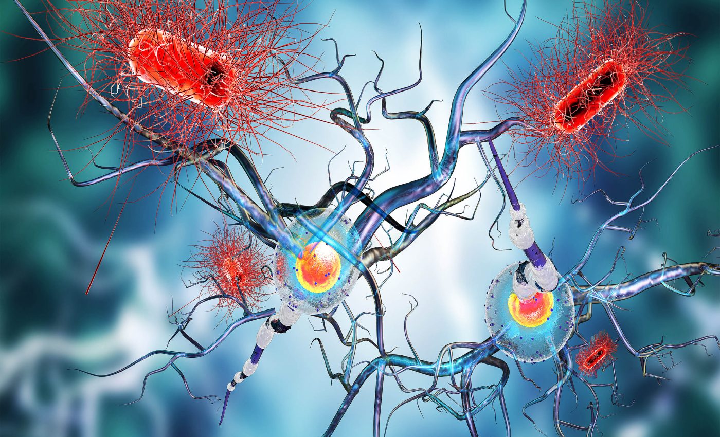Scientists think they found two key bacteria that cause multiple sclerosis