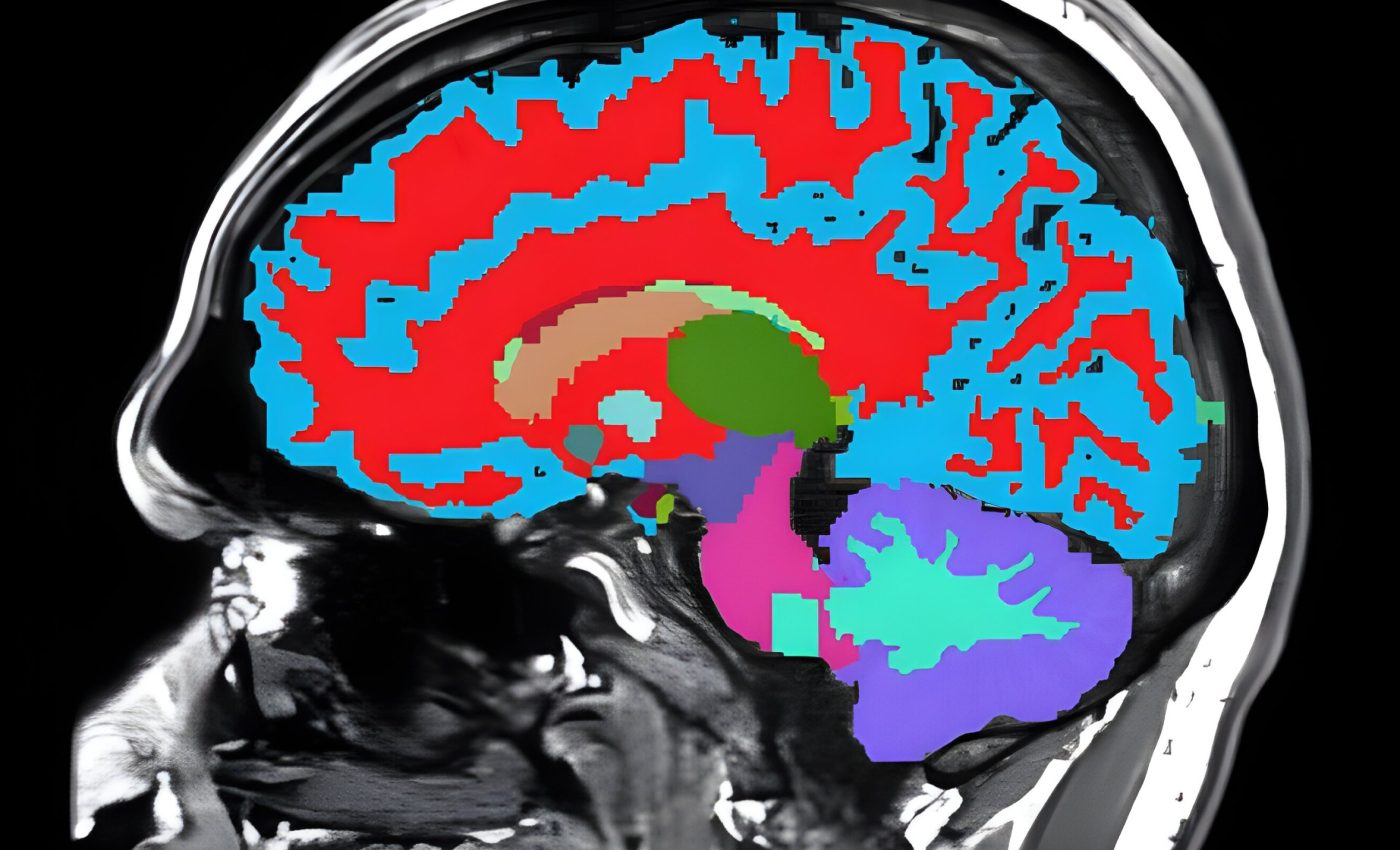 How fast are you aging? Brain scans reveal hidden clues