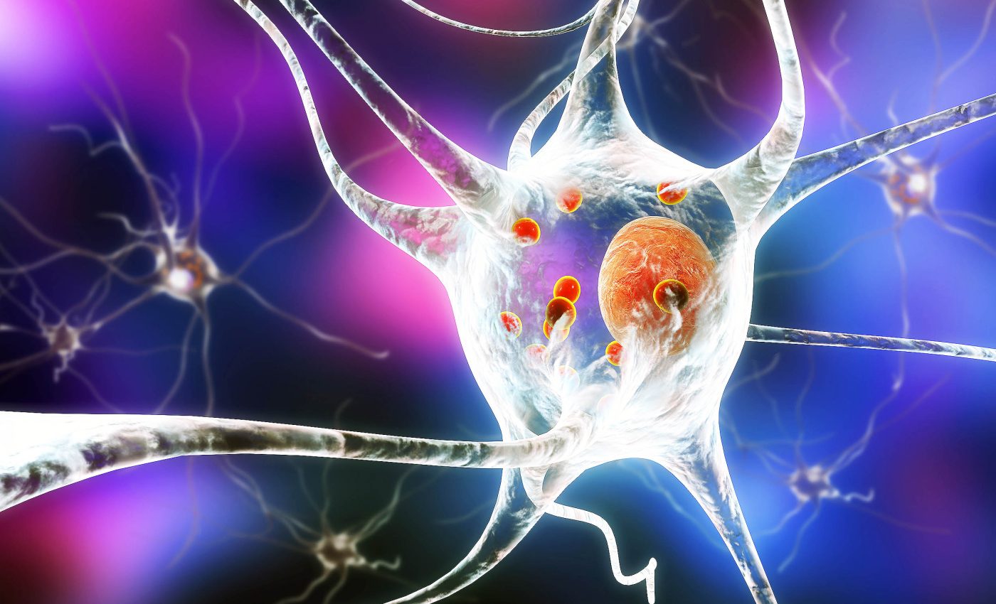 Cancer drug identified that also works to slow Parkinson's disease, according to scientists