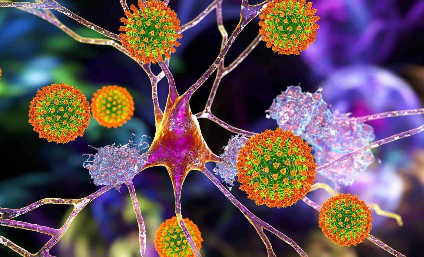 Covid aged our brains, even if you weren't infected - here's how it happened