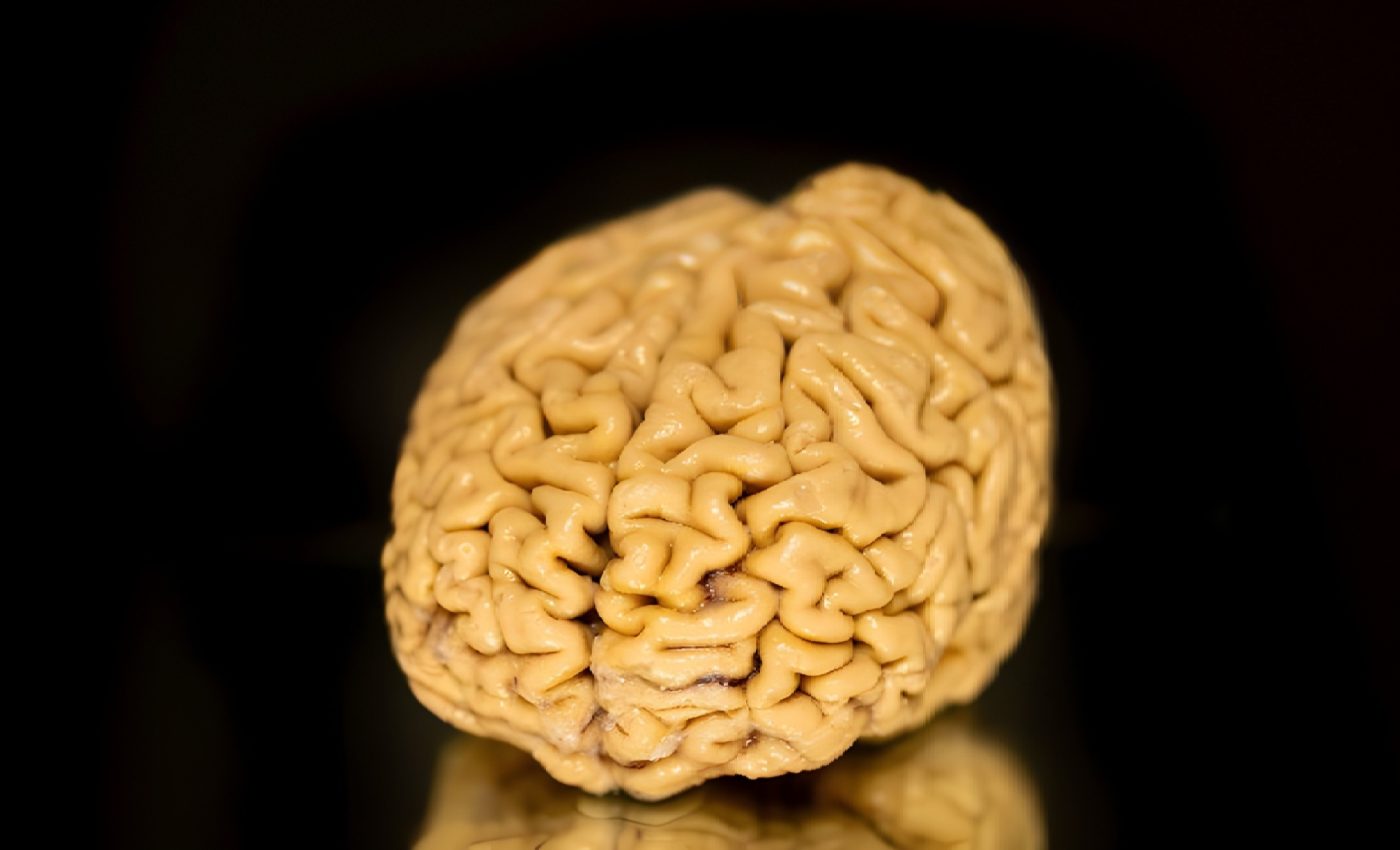 SuperAgers have a brain that can resist Alzheimer’s