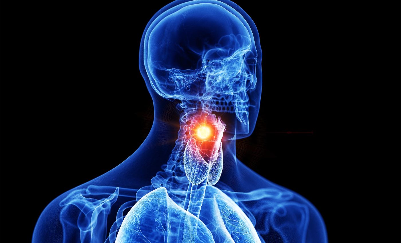 AI may diagnose voice box cancer just by listening to your voice