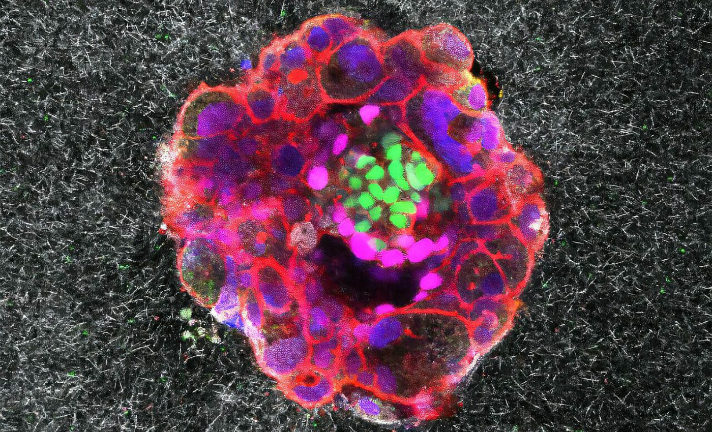 Breakthrough imaging technology shows embryo implantation for the first time