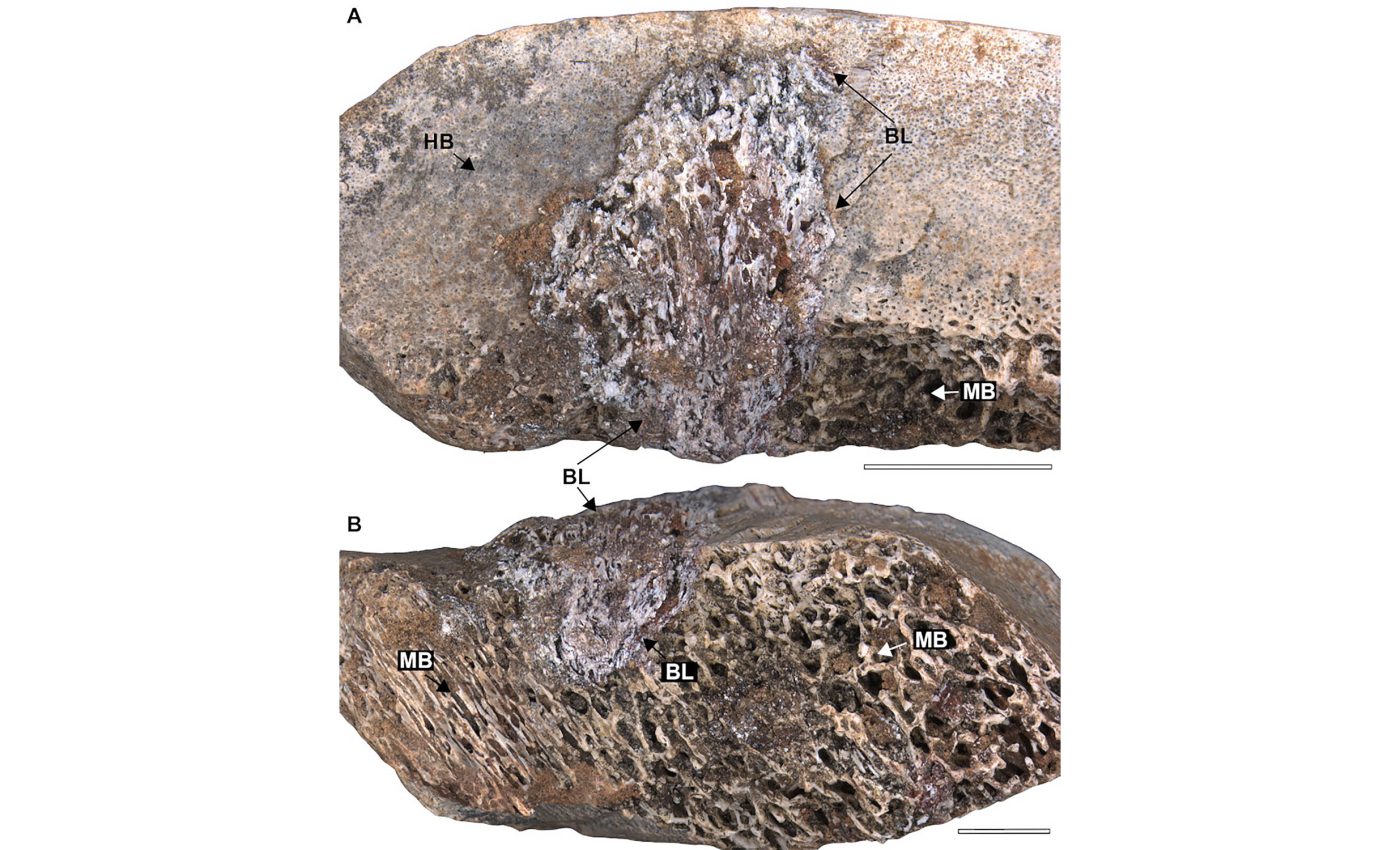 Giant, long-necked dinosaurs struggled with fatal bone disease