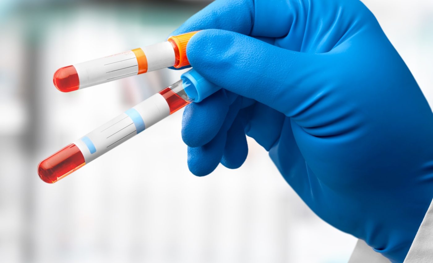 New blood test shows how fast our organs are aging